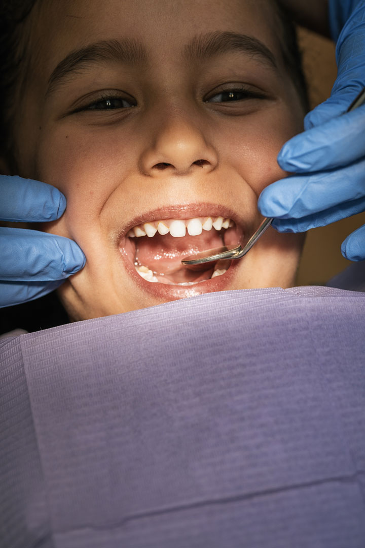 close-up-of-dentist-during-a-dental-intervention-w-UBW5BH9