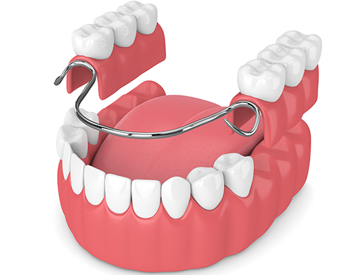 Prothese-Aix-en-Provence-Soins