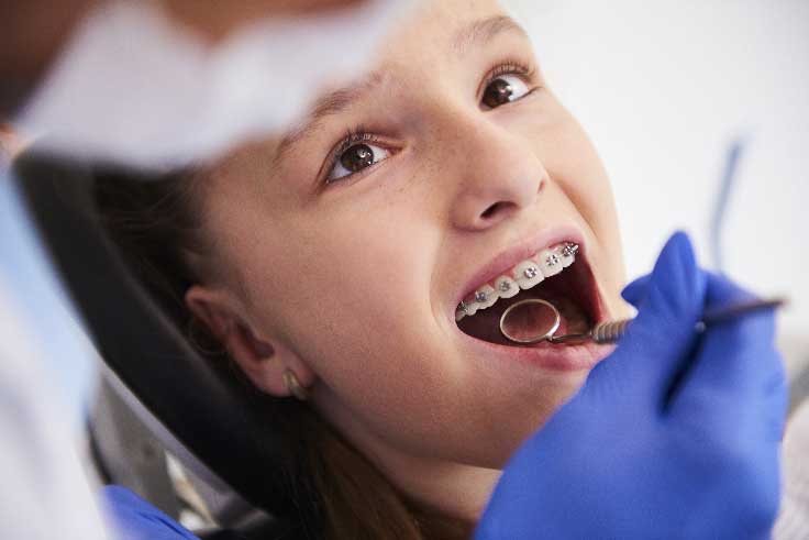 girl-with-braces-during-a-routine-dental-examinati-VZBLSY4