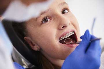 girl-with-braces-during-a-routine-dental-examinati-VZBLSYtb