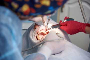 surgery-in-a-dental-clinic-PHFDPH5-tb