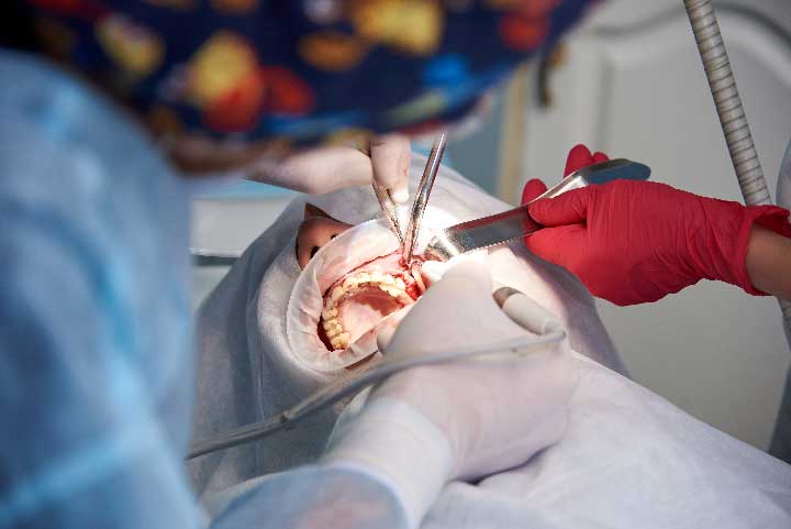 surgery-in-a-dental-clinic-PHFDPH5